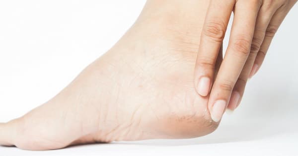 تصویر 5 از خرید و قیمت پماد ترمیمی ترک پا + فروش عمده