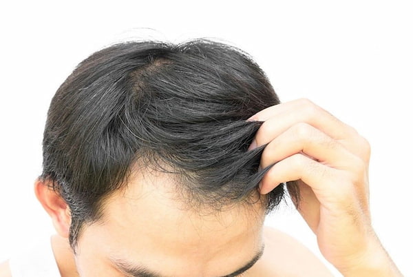 تصویر 1 از فروش ماسک مو تقویت کننده + قیمت خرید به صرفه