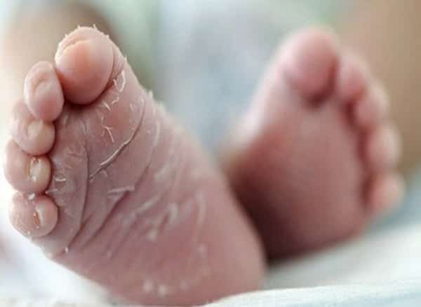 تصویر 4 از فروش کرم ترک پا کودکان + قیمت خرید به صرفه