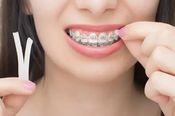 تصویر 1 از خرید و قیمت اورینگ ارتودنسی بنفش + فروش عمده