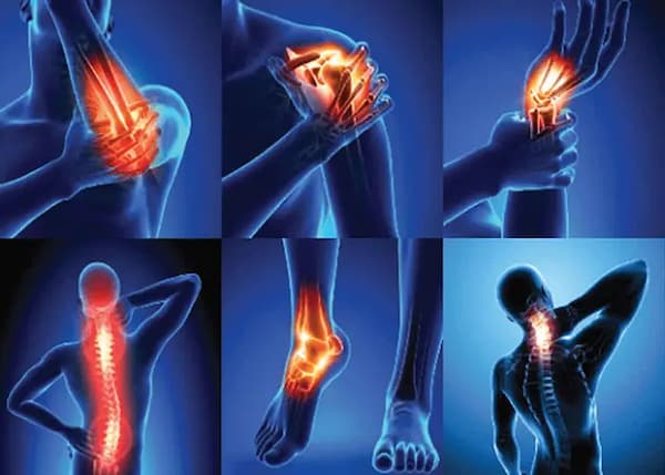 تصویر 5 از قیمت خرید ژل ضد درد خنک کننده عمده به صرفه و ارزان