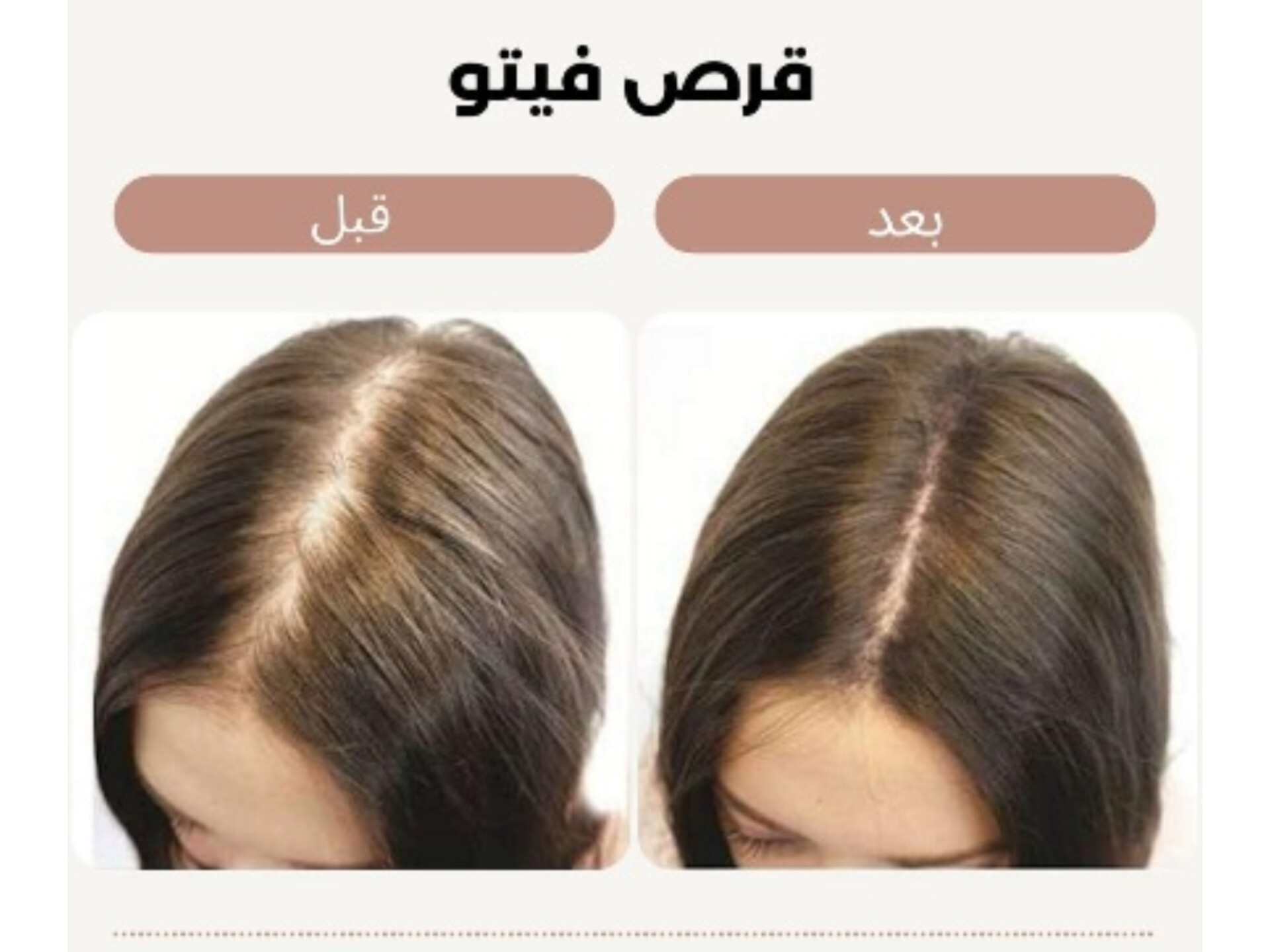 تصویر 3 از قرص تقویت کننده مو و ابرو فیتو