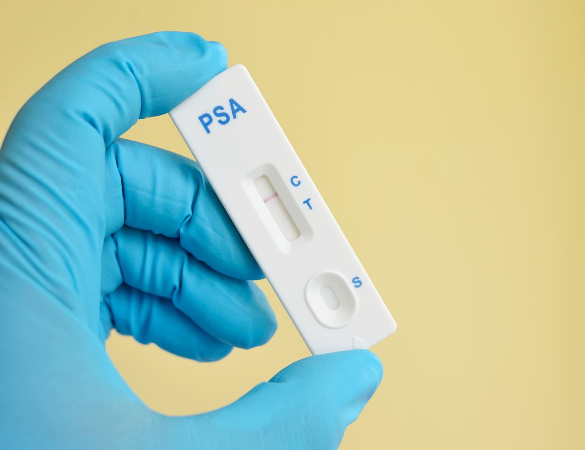 تصویر 1 از فروش کیت تشخیص سریع psa سرطان پروستات + قیمت مناسب