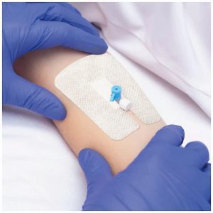 تصویر 1 از فروشگاه تجهیزات پزشکی چسب انژیوکت در تبریز