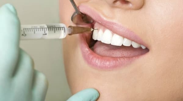 تصویر 1 از بهترین سرنگ شستشو دندانپزشکی + قیمت خرید عالی