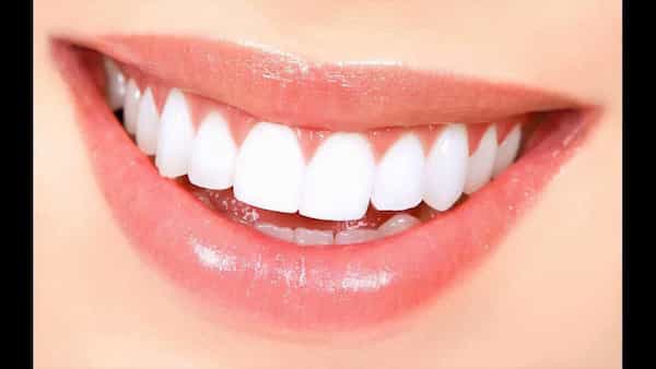 تصویر 2 از قیمت ریتینر دندان متحرک با کیفیت ارزان + خرید عمده