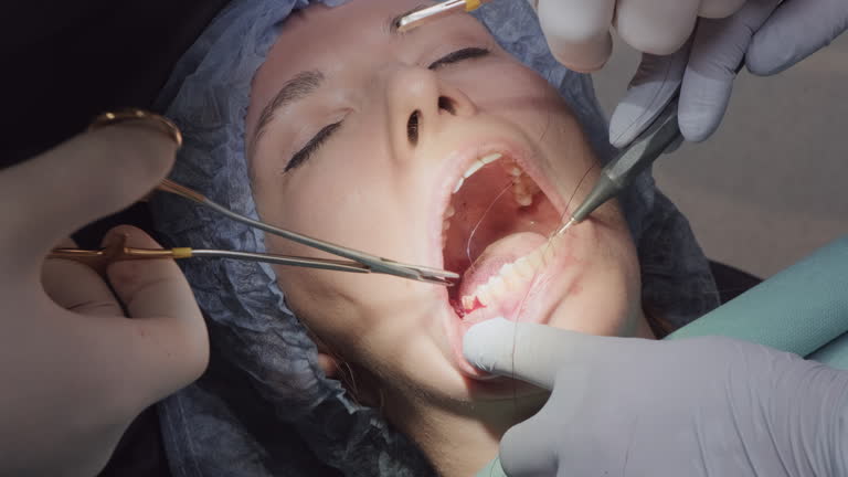 تصویر 4 از قیمت خرید نخ بخیه نایلون دندانپزشکی + فروش ویژه