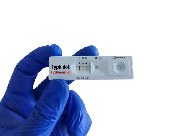 تصویر 4 از قیمت خرید کیت تشخیص آزمایشگاهی سریع تروپونین + فروش ویژه