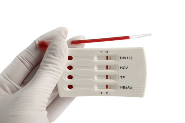 تصویر 3 از فروش کیت تشخیص آزمایشگاهی رپید اچ آی وی + قیمت خرید به صرفه