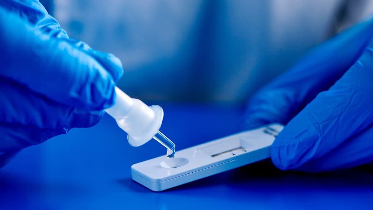 تصویر 5 از خرید و فروش کیت تشخیص آزمایشگاهی سریع هپاتیت با شرایط فوق العاده