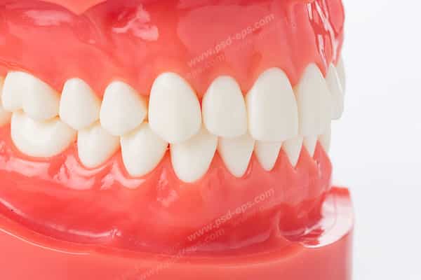 تصویر 3 از قیمت خرید دندان متحرک + فروش ویژه